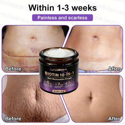Ends Today: 80% OFF!✨LUMIVO® Biotin 10-in-1 Skin Restoration Cream 🍀Made and Shipped from USA