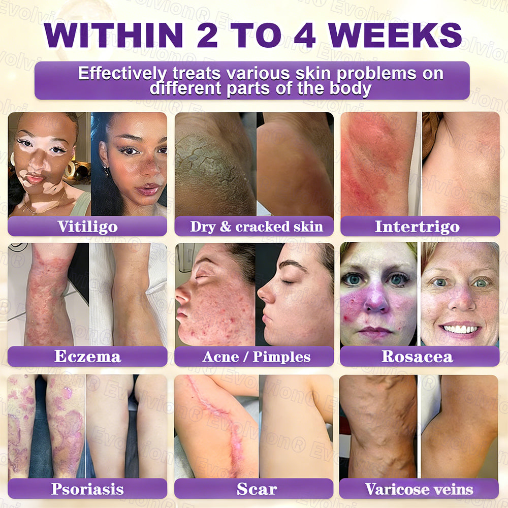 Ends Today: 80% OFF!✨LUMIVO® Biotin 10-in-1 Skin Restoration Cream 🍀Made and Shipped from USA