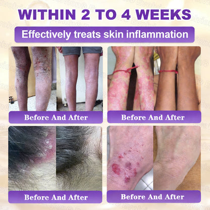 Ends Today: 80% OFF!✨LUMIVO® Biotin 10-in-1 Skin Restoration Cream 🍀Made and Shipped from USA